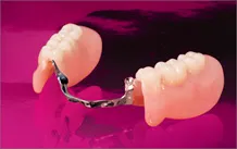 Dentures and Partial Dentures